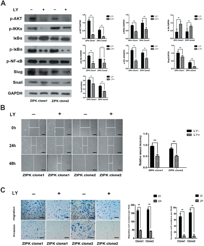 The AKT inhibitor LY294002 decreases ZIPK-induced cell migration and invasion.