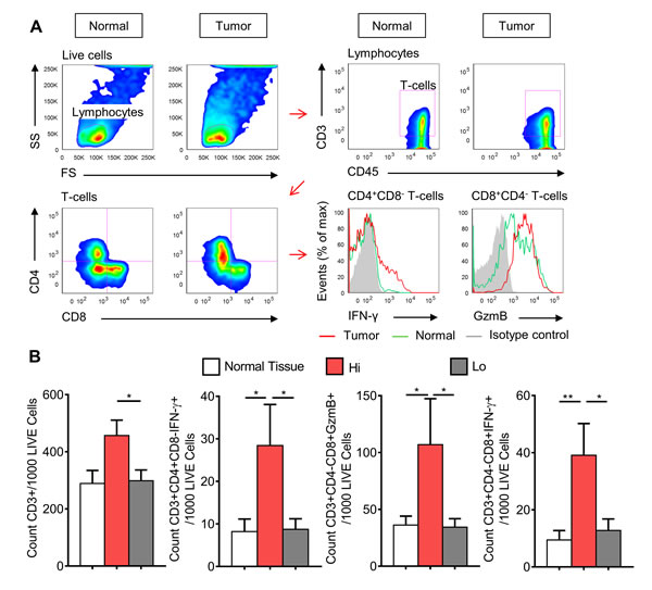 CRCs with high expression of type-1 T-cell genes have higher frequency of infiltrating IFN-&#x3b3;