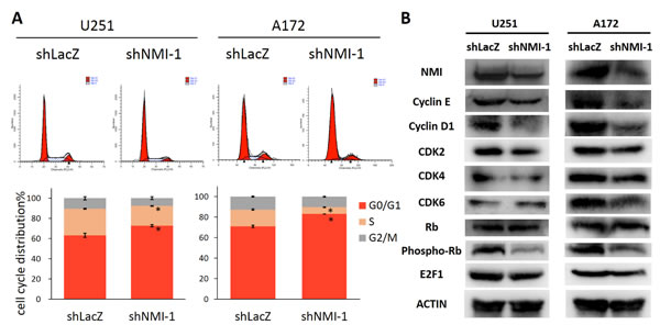 NMI regulates G1/S phase progression of glioma cell cycle.
