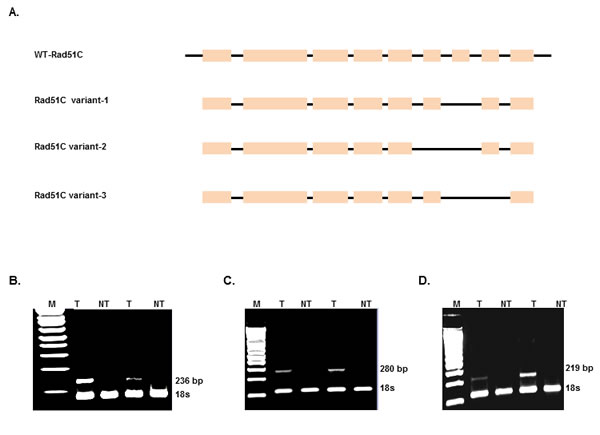 Identification of Rad51C splice variants in colorectal tumors.