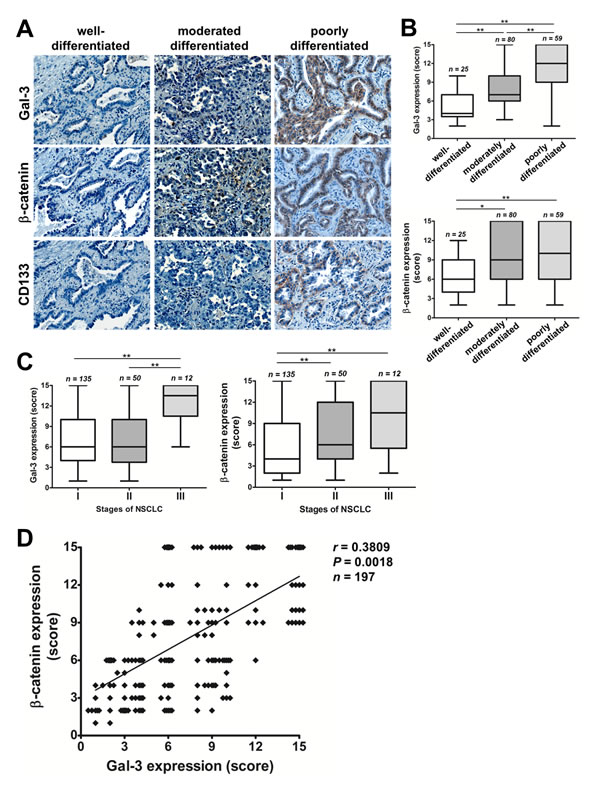 FIGURE 7: Galectin-3 expression correlated with &#x3b2;-catenin, stemness marker, and tumor progression in tissues of lung cancer.