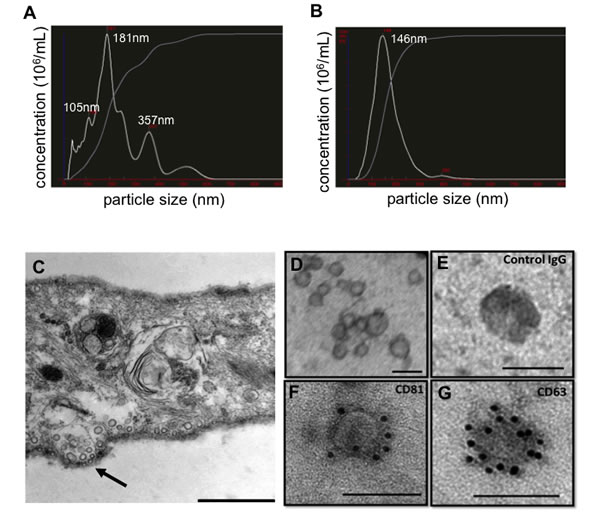 Characterization of EVs isolated from hMSCs conditioned medium.