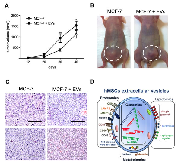 EVs enhance breast tumor growth.