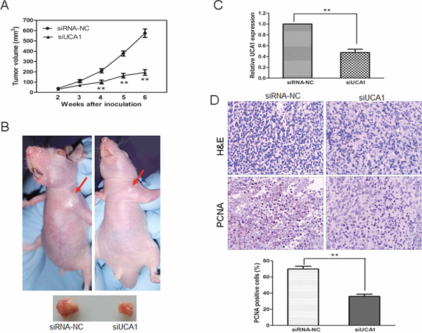 UCA1 depletion inhibits tumor growth in vivo.