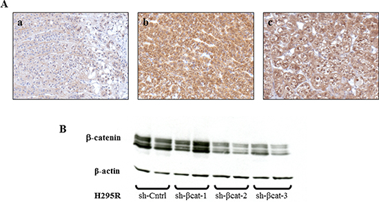 &#x03B2;-catenin expression in adrenocortical tissues and specific silencing of &#x03B2;-catenin mediated by stable expressing &#x03B2;-catenin shRNA.