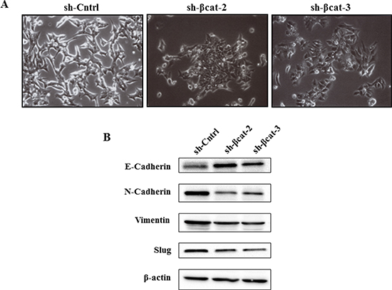 &#x03B2;-Catenin knockdown leads to changes on cellular morphology and the reversal of EMT of H295R cells.