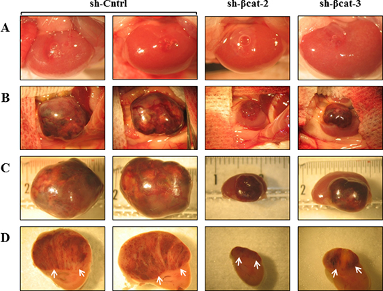 Loss of &#x03B2;-catenin leads to reduced malignant behavior of tumors formed after transplantation.