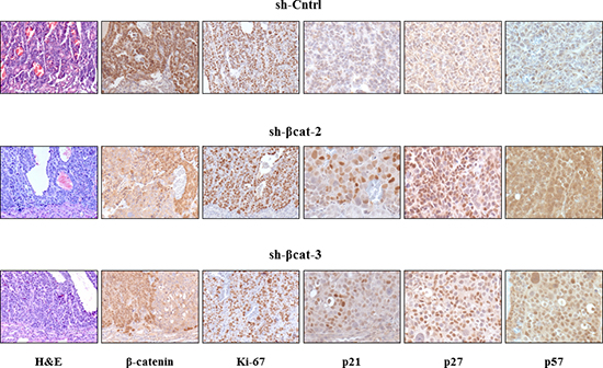 Histological appearance of tumors formed after transplantation of H295R-sh-Cntrl, -sh-&#x03B2;cat-2 and -sh-&#x03B2;cat-3 cells.