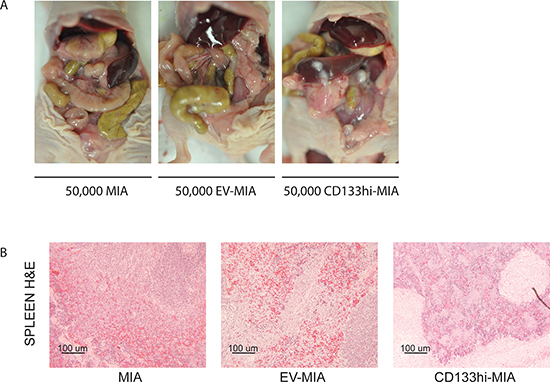 CD133 expression increased metastasis in vivo.