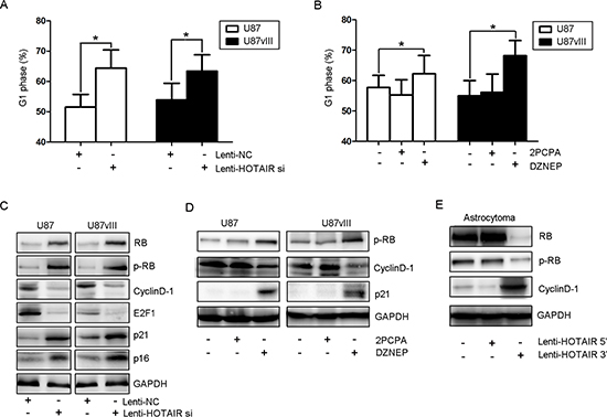 HOTAIR regulates GBM cell cycle progression in vitro.