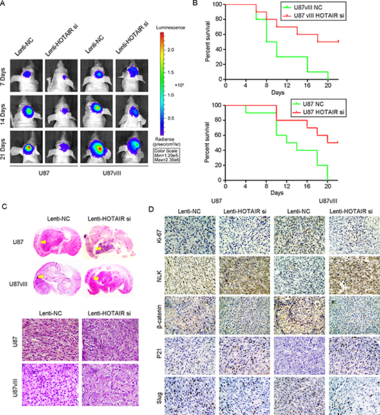 HOTAIR knockdown inhibited tumor growth in a U87 and U87vIII orthotopic GBM model in vivo.