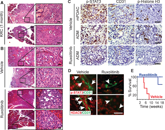 Ruxolitinib suppresses mPDAC progression and prolongs survival of KRC mice.