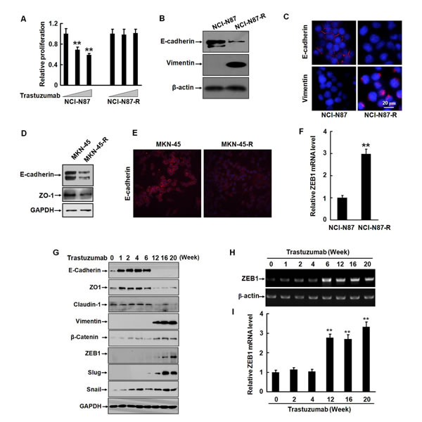 Trastuzumab resistance is associated with EMT in gastric cancer cells.