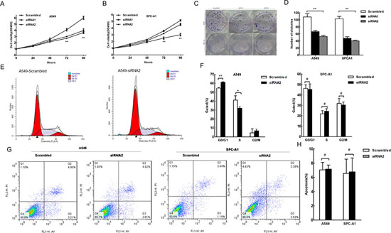 The effect of HNF1A-AS1 on lung adenocarcinoma cell proliferation, cell cycle and apoptosis in vitro.