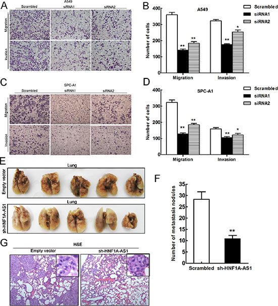 Effects of HNF1A-AS1 downexpression on tumor metastasis in vitro and in vivo.