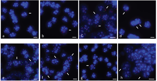 Gene amplifications in differentiation induced neurosphere cells.