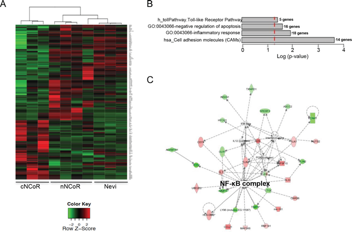 Gene expression analysis of the two MM groups and non-malignant nevi.