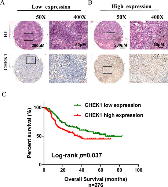 CHEK1 protein expression measured by immunehistochemical staining in tissue microarray and its association with lung cancer survival.