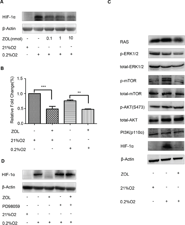 Effect of zoledronic acid on HIF-1&#x03B1; expression in MCF-7 cells.