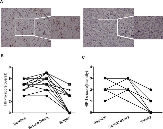 The effect of zoledronic acid combined with letrozole on endocrine therapy sensitivity in vivo.