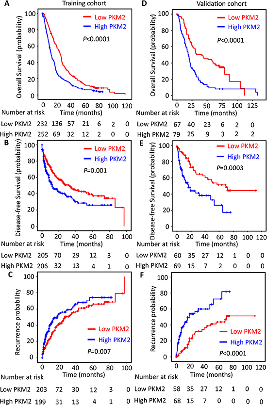 PKM2 expression is reversely correlated with outcomes of HCC patients.