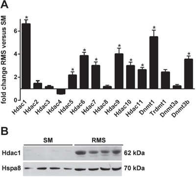 A. Expression of Hdacs, Dnmts and Trdmt1 in SM and RMS of heterozygous Ptch mice.