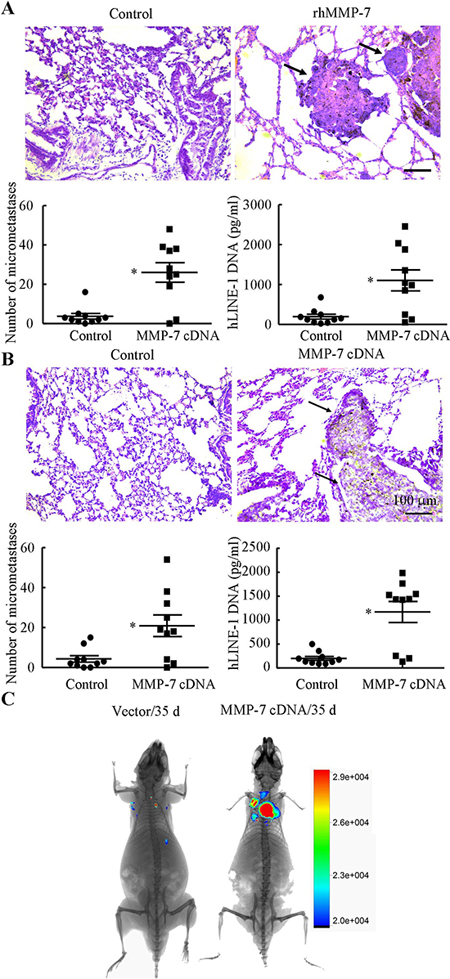 MMP-7 promotes lung colonization in vivo.