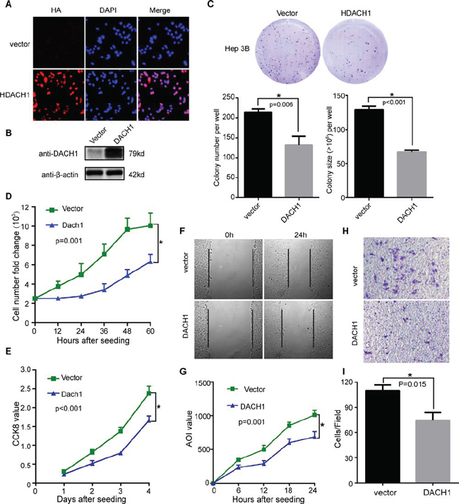 Overexpression of DACH1 suppresses cell growth and migration of HCC cell line in vitro.