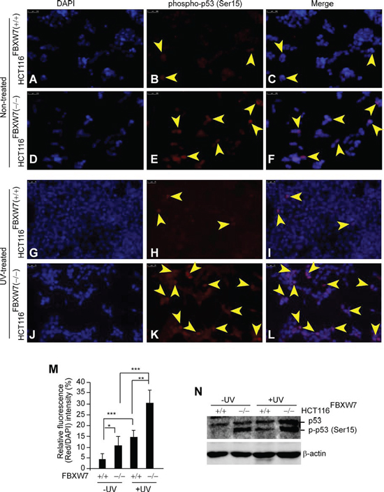In vitro validation of phospho-p53(Ser15) accumulation in FBXW7-deficient human CRC cells.