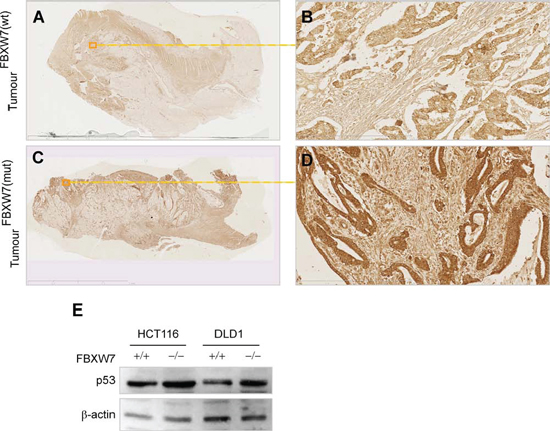 p53 levels remained unchanged in FBXW7-mutant human CRC-tissues.