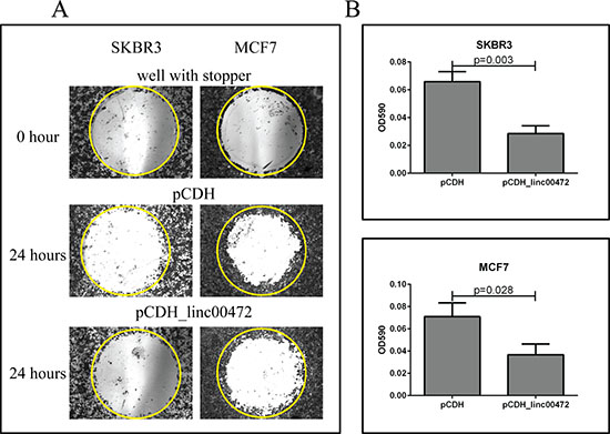Effect of LINC00472 expression on breast cancer cell migration.