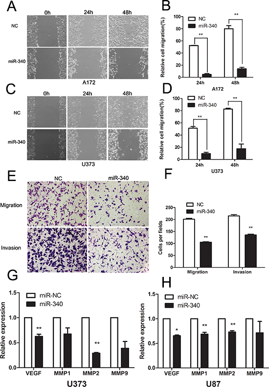 Overexpression of miR-340 inhibits glioma cells migration and invasion.