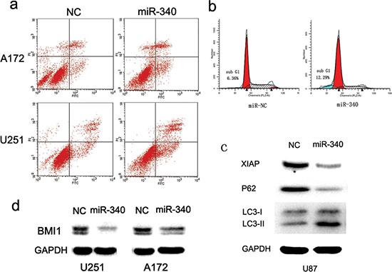 MiR-340 promotes glioma apoptosis and autophagy.