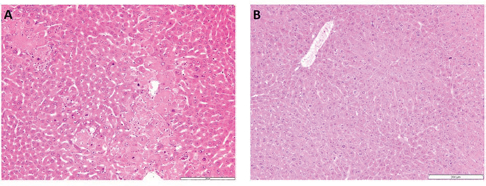 A. H&#x0026;E staining of Dkk2&#x2212;/&#x2212; liver tissue. Dkk2 deleted animals showed moderate to focally stronger variation of hepatocyte size with special regard to variable nuclear size and chromatin density.