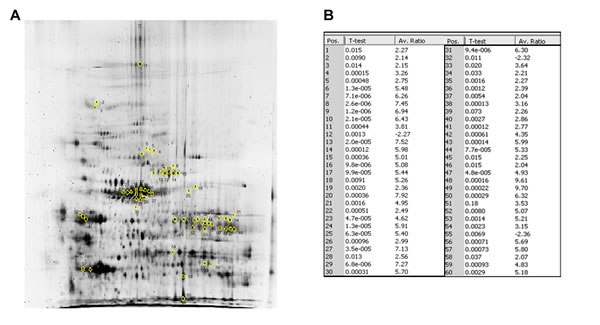 Fig.1: 2D-DIGE reveals a profile of 60 protein spots differentially expressed in ACC versus normal adrenal.