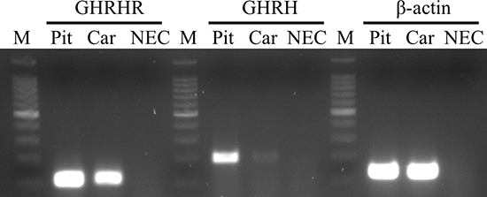 Expression of GHRH-R and GHRH mRNA in H9c2 cardiomyoblast cell line.