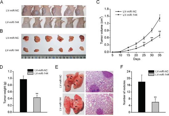 miR-144 suppresses tumorigenesis and metastasis in nude mice.