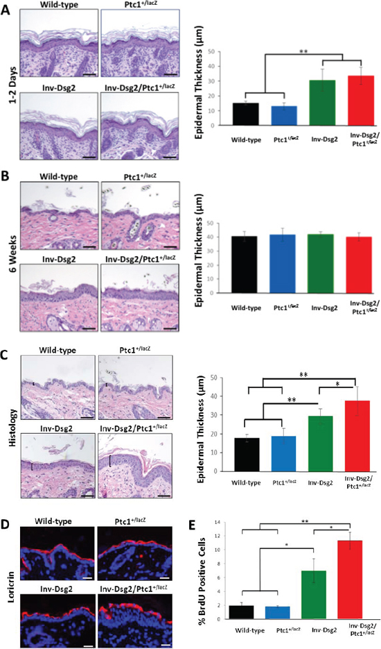 Inv-Dsg2/Ptc1+/lacZ mice exhibit epidermal hyperproliferation.