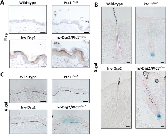 Inv-Dsg2/Ptc1+/lacZ mice exhibit interfollicular activation of the Hh pathway.