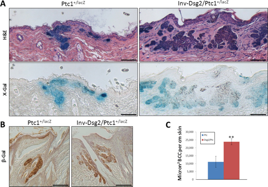 DMBA-TPA induces enhanced BCC formation in Inv-Dsg2/Ptc1+/LacZ mice.