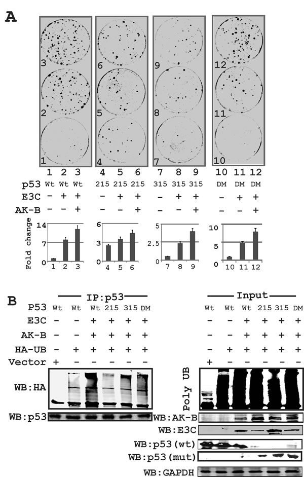 Fig 5: The p53 mutation at amino acid 215 is critical for AK-B and EBNA3C dependent cell proliferation.