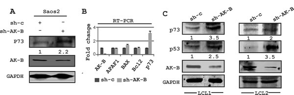 Expression of DNA damage markers in AK-B knockdown cells.