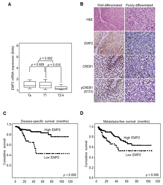 Downregulation of EMP2 immunointensity confers poor disease-specific survival (DSS) and metastasis-free survival (MFS) in UBUC patients.