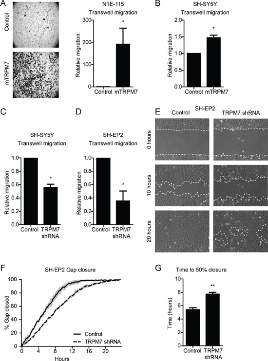 TRPM7 drives mouse and human neuroblastoma cell migration.