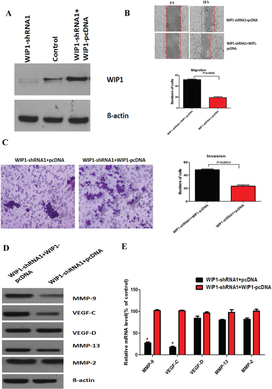 WIP1 modulates cell migration and invasion by regulating MMP-9 and VEGF-C expression.