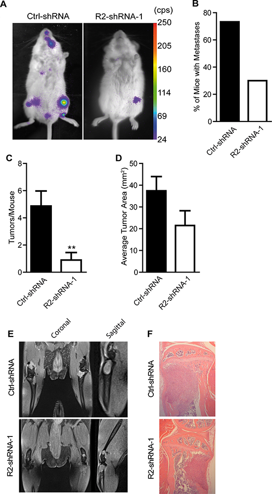 Knockdown of TRAIL-R2 impairs the formation of bone metastasis in vivo.