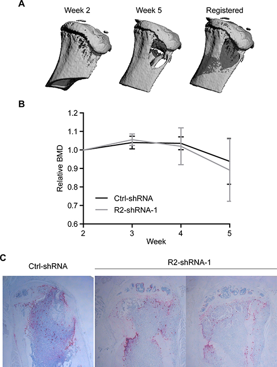 TRAIL-R2 status does not affect osteolysis in MDA-MB-231-BO-derived bone lesions.
