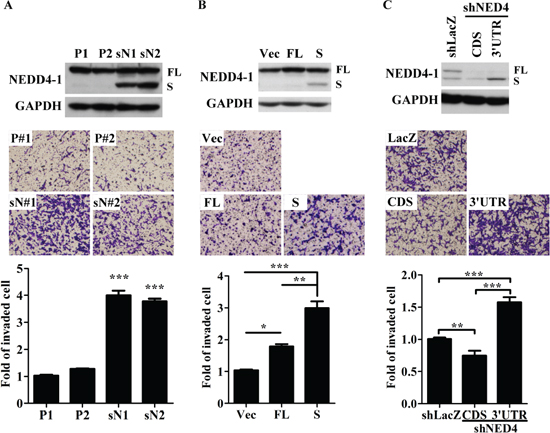 sNEDD4 promotes tumor cell invasion in vitro.