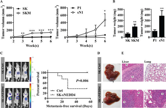 sNEDD4 promotes tumorigenesis and metastasis in vivo.