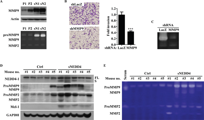 sNEDD4 promotes tumor invasion through MMP9.